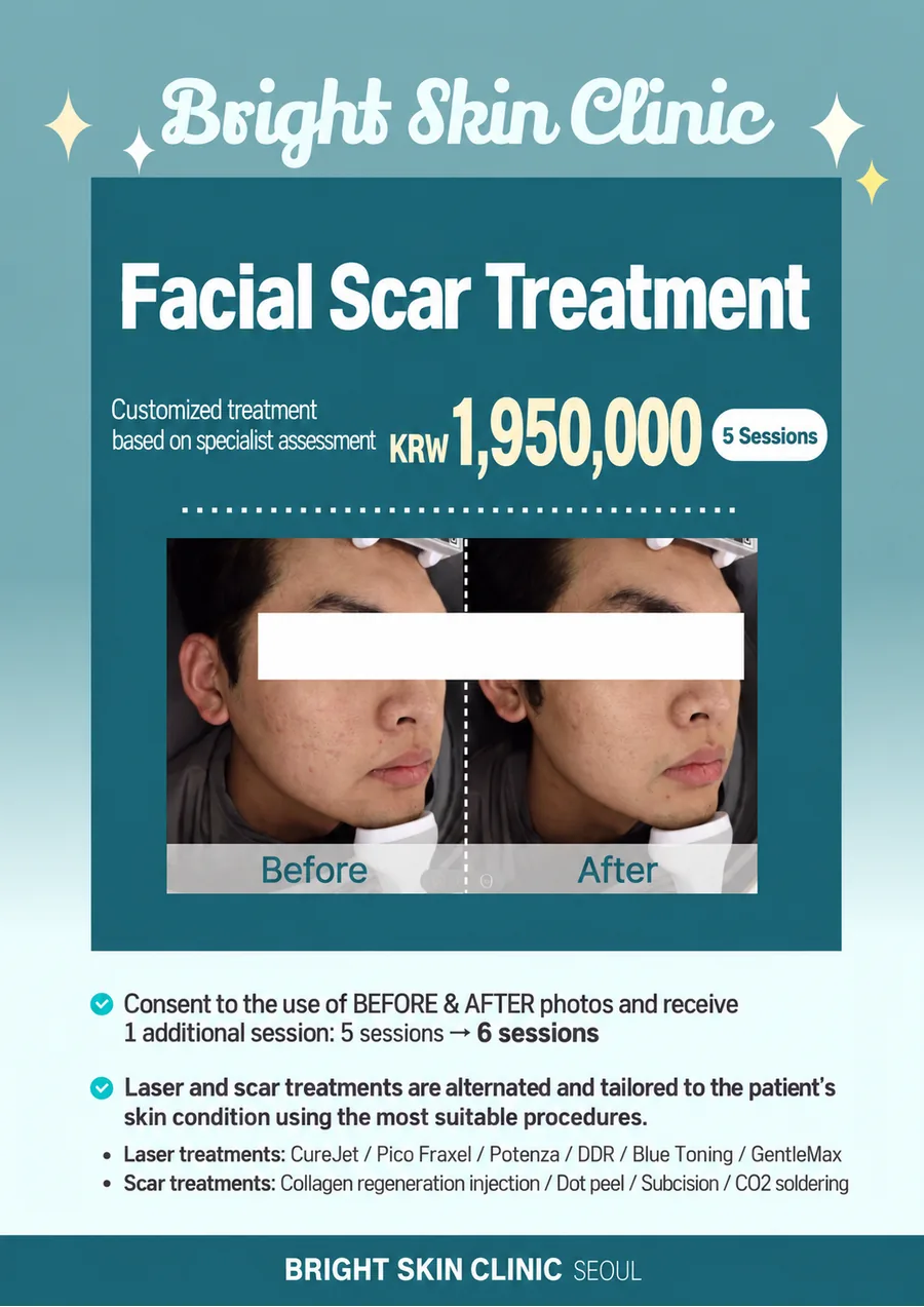 Scar Treatment Package