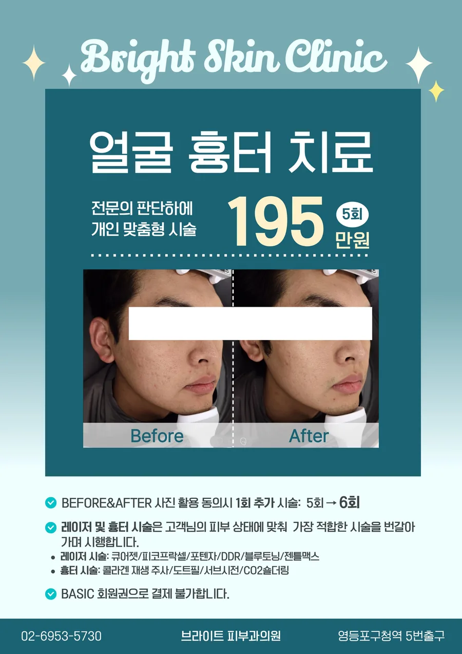 흉터치료 패키지